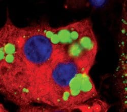 HSL Polyclonal Antibody:Antibodies, Polyclonal