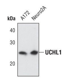 Invitrogen PGP9.5 Polyclonal Antibody 100 &mu;L; Unconjugated:Antikroppar