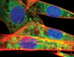 ATG12 Polyclonal Antibody:Antibodies, Polyclonal
