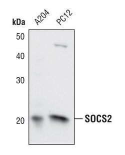 Invitrogen SOCS2 Polyclonal Antibody 100 &mu;L; Unconjugated:Antibodies,
