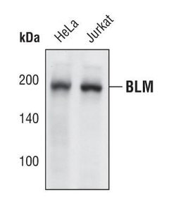 Blooms Syndrome Polyclonal Antibody:Antibodies, Polyclonal