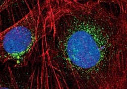 Invitrogen EEA1 Polyclonal Antibody 100 &mu;L; Unconjugated:Antibodies,