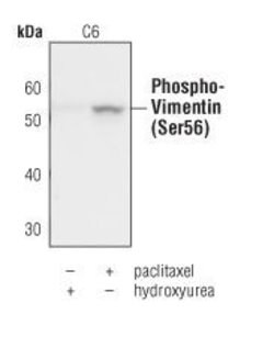 Invitrogen Phospho-Vimentin (Ser56) Polyclonal Antibody 100 &mu;L; Unconjugated:Antibodies,