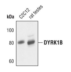 DYRK1B Polyclonal Antibody:Antibodies, Polyclonal