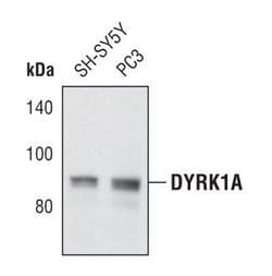 DYRK1A Polyclonal Antibody:Antibodies, Polyclonal