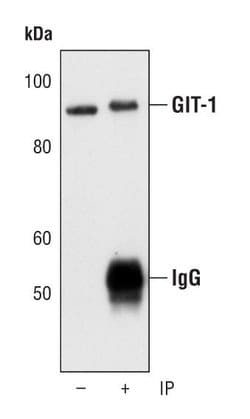 Invitrogen GIT1 Polyclonal Antibody 100 &mu;L; Unconjugated:Antibodies,