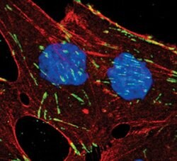 Invitrogen ITGB5 Polyclonal Antibody 100 μL; Unconjugated:Antibodies,