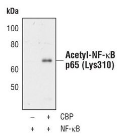 Invitrogen Acetyl-NFkB p65 (Lys310) Polyclonal Antibody 100 &mu;L; Unconjugated:Antibodies,
