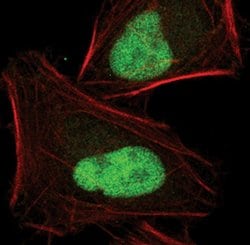 Invitrogen JunB Polyclonal Antibody 100 &mu;L; Unconjugated:Antibodies,