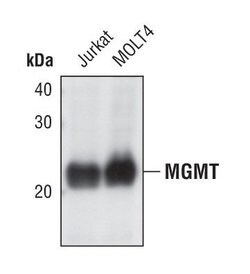 Invitrogen MGMT Polyclonal Antibody 100 &mu;L; Unconjugated:Antibodies,