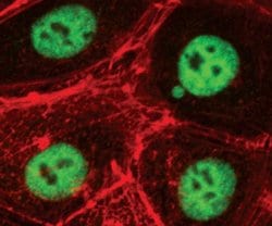 Invitrogen PRMT1 Polyclonal Antibody 100 &mu;L; Unconjugated:Antibodies,