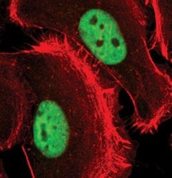 Invitrogen PRMT1 Polyclonal Antibody 100 &mu;L; Unconjugated:Antibodies,