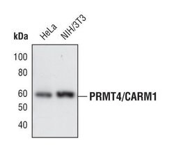 PRMT4 Polyclonal Antibody, Invitrogen 100 &mu;L; Unconjugated:Antibodies,
