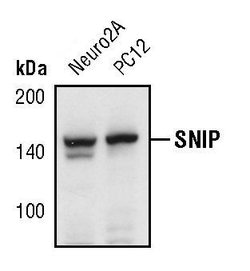 SNIP Polyclonal Antibody, Invitrogen 100 &mu;L; Unconjugated:Antibodies,