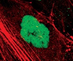 Invitrogen SETD7 Polyclonal Antibody 100 &mu;L; Unconjugated:Antibodies,