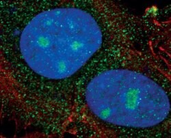 Invitrogen PSME2 Polyclonal Antibody 100 &mu;L; Unconjugated:Antibodies,
