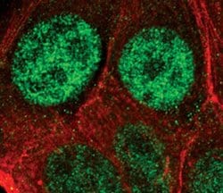 Invitrogen PSME3 Polyclonal Antibody 100 &mu;L; Unconjugated:Antibodies,