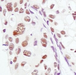 Invitrogen PSME3 Polyclonal Antibody 100 &mu;L; Unconjugated:Antibodies,