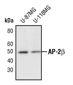 Invitrogen AP2 beta Polyclonal Antibody 100 &mu;L; Unconjugated:Antibodies,