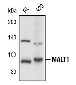 MALT1 Polyclonal Antibody, Invitrogen 100 &mu;L; Unconjugated:Antibodies,