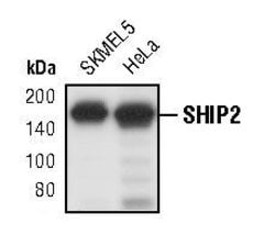 Invitrogen SHIP2 Polyclonal Antibody 100 &mu;L | Buy Online | Invitrogen&trade; | Fisher Scientific