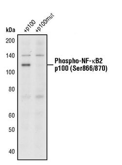 Invitrogen Phospho-NFkB p100 (Ser866, Ser870) Polyclonal Antibody 100 &mu;L | Buy Online | Invitrogen&trade; | Fisher Scientific