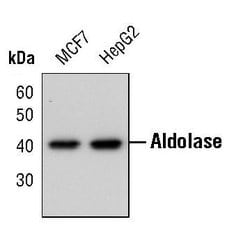 Invitrogen Aldolase A Polyclonal Antibody 100 &mu;L; Unconjugated:Antibodies,