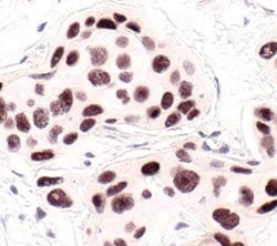 Invitrogen HP1 alpha Polyclonal Antibody 100 &mu;L; Unconjugated:Antibodies,