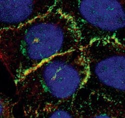 Invitrogen Catenin alpha-1 Polyclonal Antibody 100 &mu;L | Buy Online | Invitrogen&trade; | Fisher Scientific