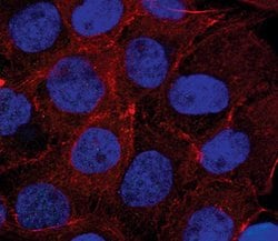 Invitrogen Catenin alpha-1 Polyclonal Antibody 100 &mu;L | Buy Online | Invitrogen&trade; | Fisher Scientific
