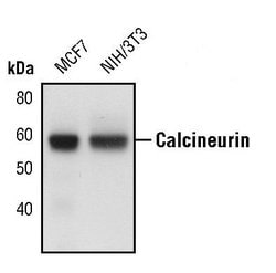 Invitrogen Calcineurin A Polyclonal Antibody 100 &mu;L; Unconjugated:Antibodies,