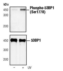 Invitrogen Phospho-53BP1 (Ser1778) Polyclonal Antibody 100 &mu;L | Buy Online | Invitrogen&trade; | Fisher Scientific