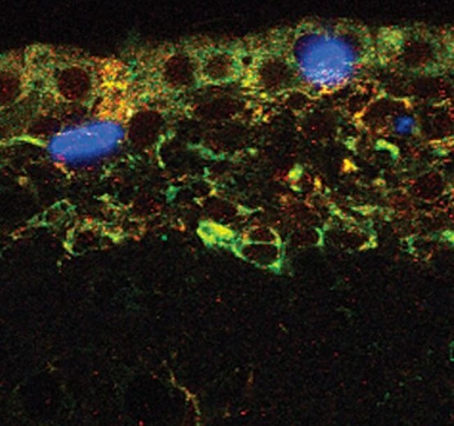 MSI1 Polyclonal Antibody, Invitrogen™ 100 μL; Unconjugated | Fisher ...