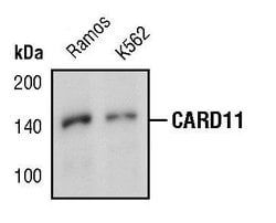 Invitrogen CARD11 Polyclonal Antibody 100 &mu;L | Buy Online | Invitrogen&trade; | Fisher Scientific