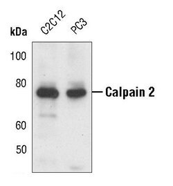 Invitrogen Calpain 2 Polyclonal Antibody 100 &mu;L | Buy Online | Invitrogen&trade; | Fisher Scientific