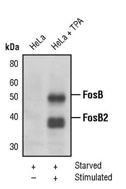 Invitrogen FosB Polyclonal Antibody 100 &mu;L; Unconjugated:Antibodies,