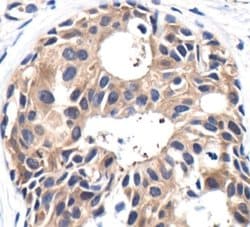 Invitrogen PP2A alpha Polyclonal Antibody 100 &mu;L; Unconjugated:Antibodies,