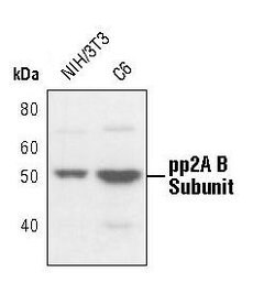 Invitrogen PPP2R2A Polyclonal Antibody 100 &mu;L; Unconjugated:Antibodies,