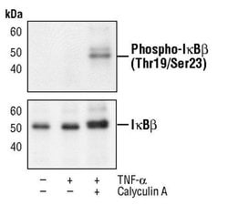 Invitrogen Phospho-IkB beta (Thr19, Ser23) Polyclonal Antibody 100 &mu;L | Buy Online | Invitrogen&trade; | Fisher Scientific