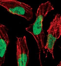 Invitrogen Phospho-p57 Kip2 (Thr310) Polyclonal Antibody 100 &mu;L; Unconjugated:Antibodies,