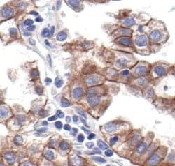 Invitrogen N-cadherin Polyclonal Antibody 100 &mu;L; Unconjugated:Antibodies,