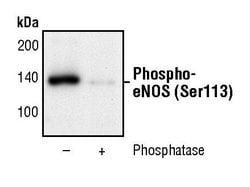 Invitrogen Phospho-eNOS (Ser113) Polyclonal Antibody 100 μL; Unconjugated:Antibodies,
