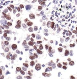 Invitrogen Phospho-RNA pol II CTD (Ser2, Ser5) Polyclonal Antibody 100