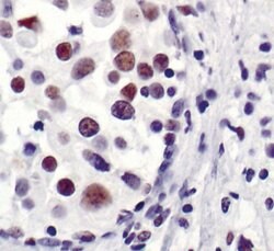 Invitrogen 53BP1 Polyclonal Antibody 100 &mu;L; Unconjugated:Antibodies,