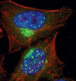 Invitrogen PKA alpha Polyclonal Antibody 100 &mu;L; Unconjugated:Antibodies,