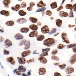 Invitrogen H2AK5ac Polyclonal Antibody 100 &mu;L; Unconjugated:Antibodies,