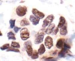 Invitrogen Phospho-MAPKAPK2 (Thr334) Polyclonal Antibody 100 &mu;L; Unconjugated:Antibodies,