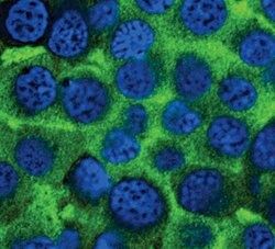 Invitrogen Tyrosine Hydroxylase Polyclonal Antibody 100 &mu;L; Unconjugated:Antibodies,