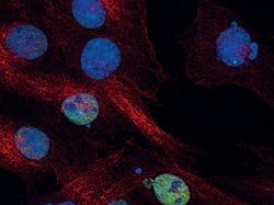 Invitrogen Phospho-c-Jun (Ser73) Polyclonal Antibody 100 &mu;L; Unconjugated:Anticuerpos