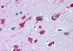 Alsin Polyclonal Antibody, Invitrogen 100 &mu;g; Unconjugated:Antibodies,